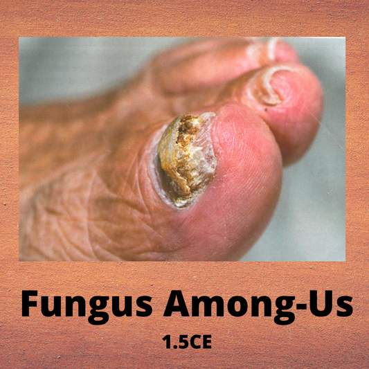Fungus Among-us - Fungal Infection Treatment Training Video