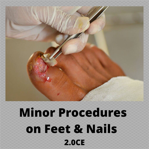 Minor Procedures on the Nails & Feet - Clinical Training Video