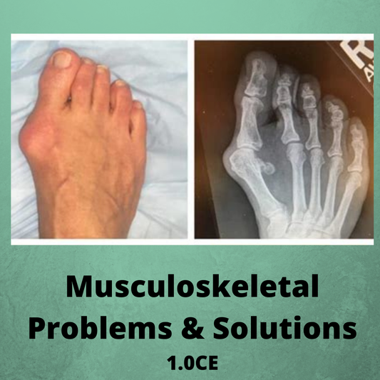 Musculoskeletal Problems & Solutions - Foot Care Training Video